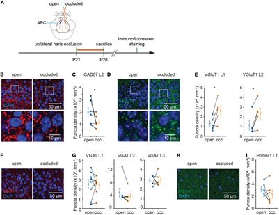 TNF-α Orchestrates Experience-Dependent Plasticity of Excitatory and Inhibitory Synapses in the Anterior Piriform Cortex